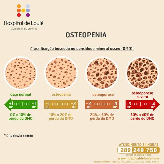 Osteopenia