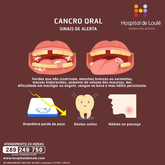 Cancro oral